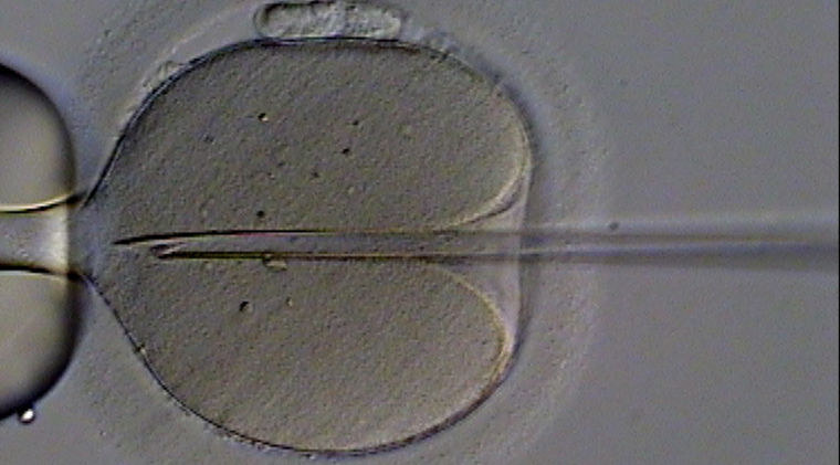 In Vitro — micrograph of an egg being injected
